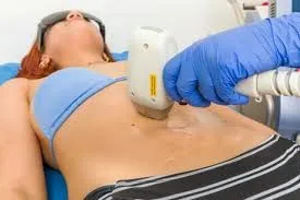 HIFU corporal y tratamientos corporales: tecnología con criterio clínico